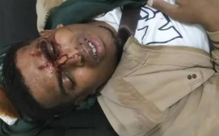 إعلامي ينجو من محاولة اغتيال في الشمايتين بعد كشفه قضايا إنسانية حساسة