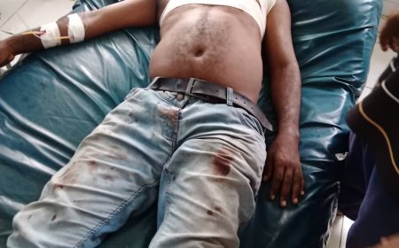 هجوم مسلح يستهدف حافلة موظفين شركة أسمنت الوحدة في أبين ويُصيب شخصين