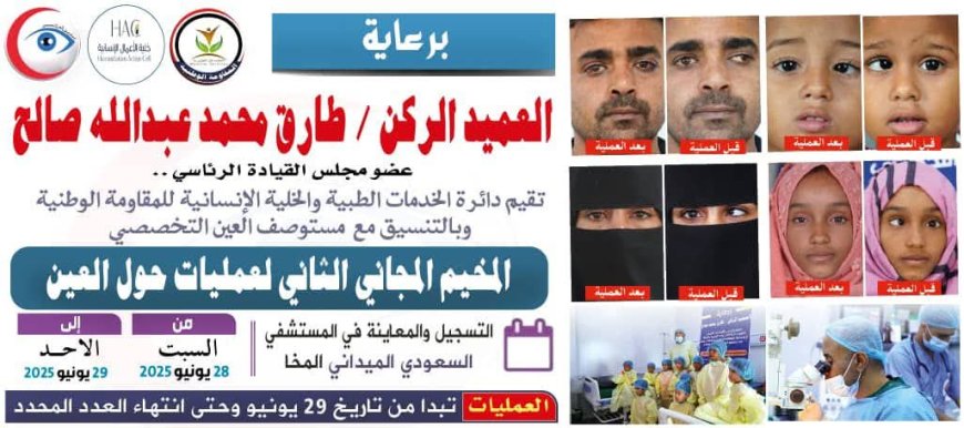 أكثر من 150 عملية مجانية ناجحة في مخيم طبي لجراحة حَوَل العين في المخا.