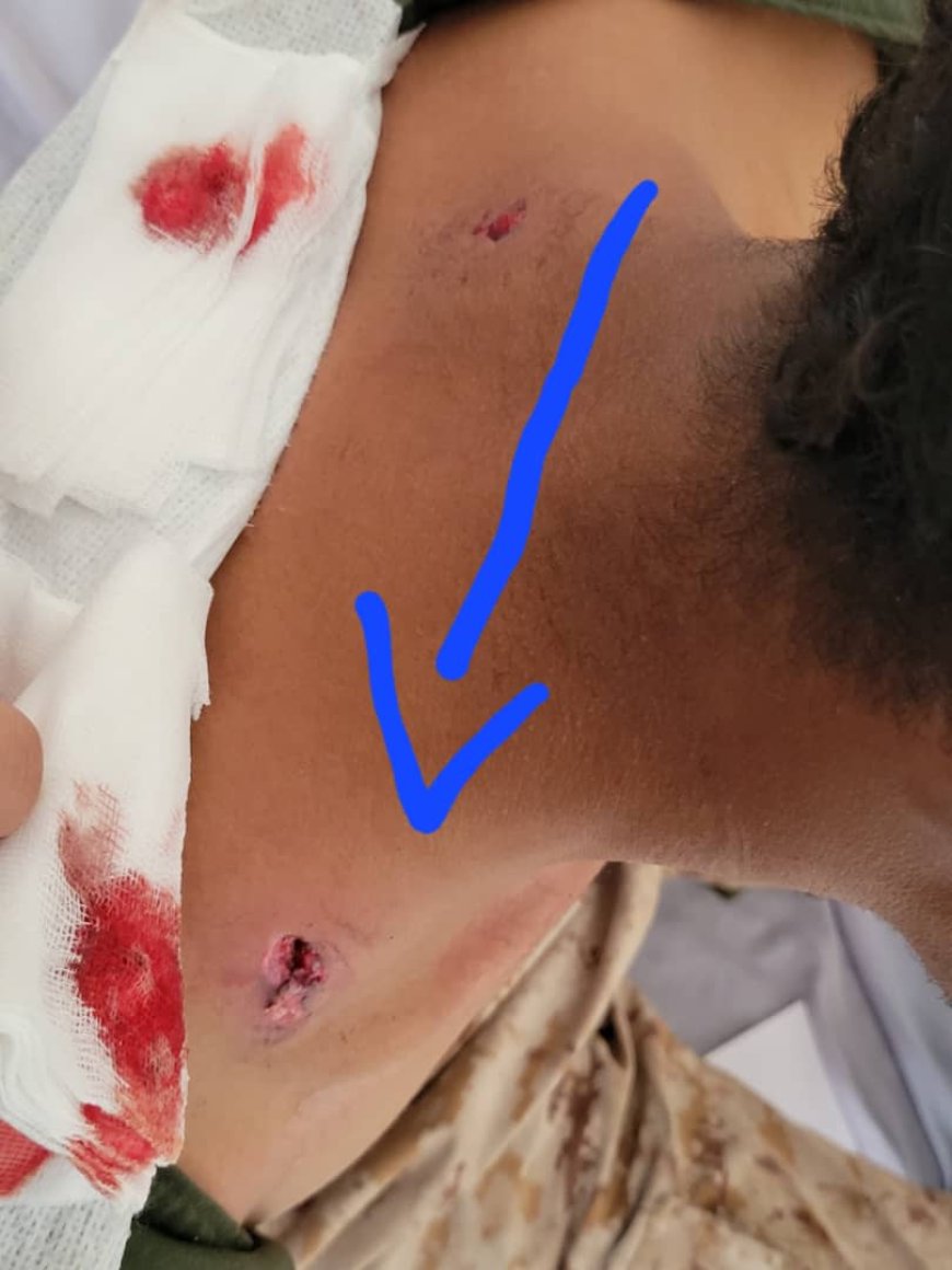 إصابة جندي برصاصة قناص حوثي في جبهة مريس بالضالع