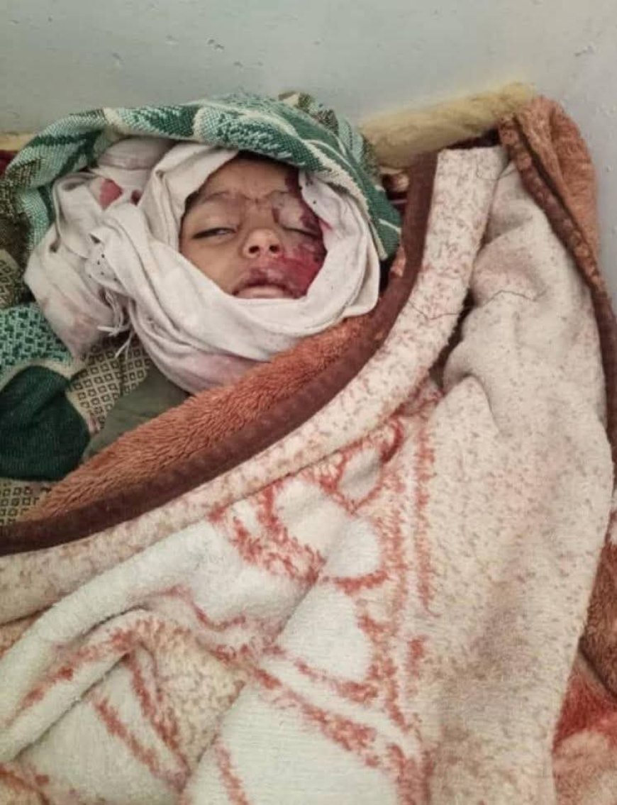 وفاة طفل بسبب ازدحام خلف سيارة نقل مياه في مشرعة وحدنان جراء أزمة عطش خانقة