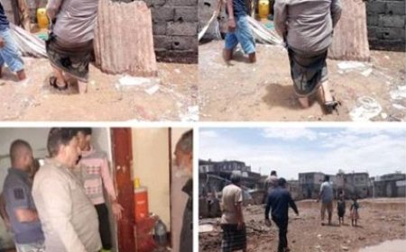 الجبلي يتفقد أحياء الحوطة ويشيد بجهود المحافظ تركي في مواجهة آثار الأمطار