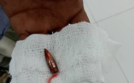 إصابة لاعب كرة سلة في شبام برصاص راجع إثر إطلاق نار مجهول المصدر