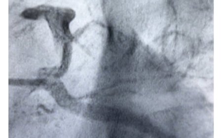 من فراغ قاتل إلى جلطة قلبية.. د. عبدالوهاب الماتري يحذر من مادة غامضة تفتك بشباب اليمن