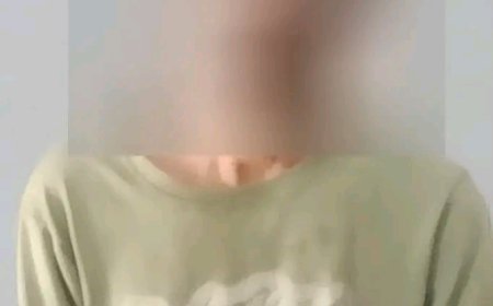 أمن العاصمة عدن يضبط أحد أخطر سارقي محتويات المركبات متلبساً وبحوزته مسروقات