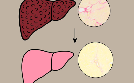 صبغة الحناء لعلاج تليّف الكبد