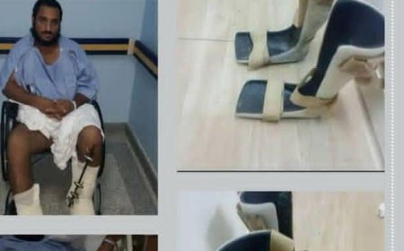 جريح في محور البقع بصعدة يعرض حذاءه الصناعي للبيع بعد توقف راتبه.