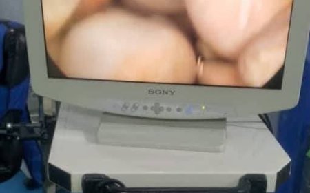 إنجاز طبي في المستشفى التخصصي الخيري عزان شبوة : استخراج 193 حصوة من مثانة مريض بالمنظار على يد الدكتور معمر الحميدي