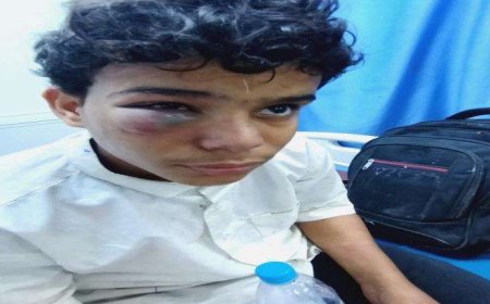 مهاجرين أفارقة يعتدون بوحشية على طفل في المكلا