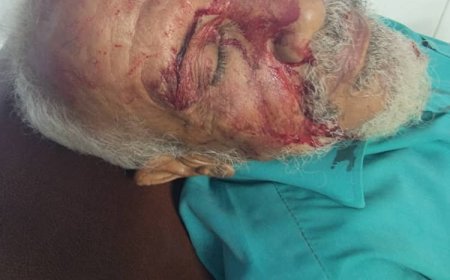 مدير عام الحوطة يدعو إلى حماية فرق مكافحة الملاريا ويستنكر الاعتداء على أحد أفرادها