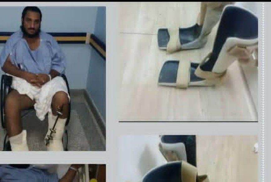 جريح في محور البقع بصعدة يعرض حذاءه الصناعي للبيع بعد توقف راتبه.