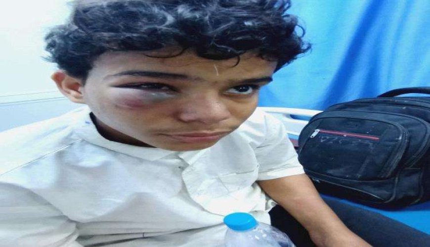 مهاجرين أفارقة يعتدون بوحشية على طفل في المكلا