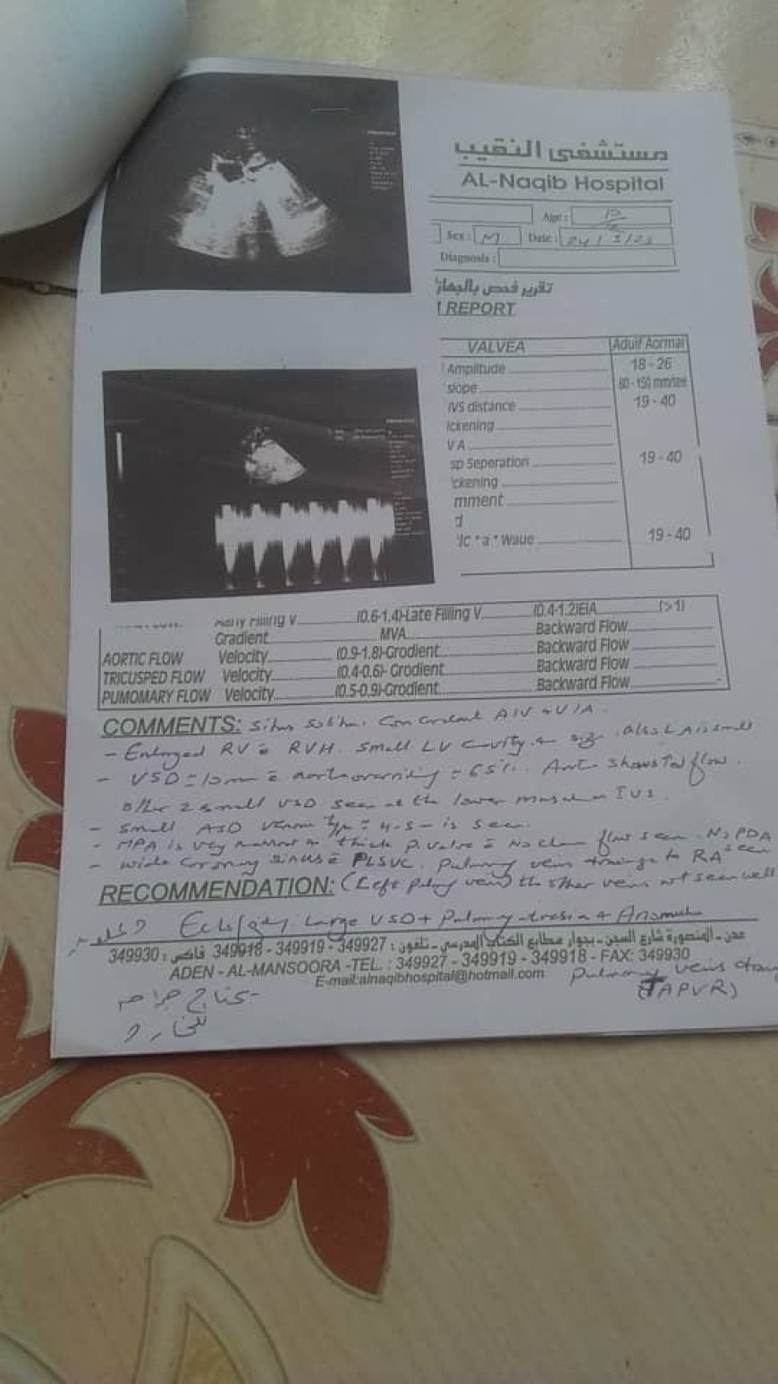 مناشدة لفاعلي الخير لإنقاذ الطفل " محمد مازن صالح فضل