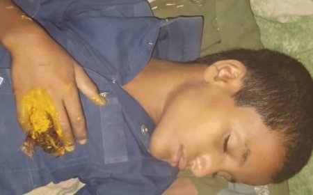 حجة.مدرس يعذب طفل فيها مديرية بني قيس و التربية تتستر.