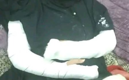 تعز.محامية تتعرض لإعتداء وحشي داخل منزلها من أحد أرقابها.