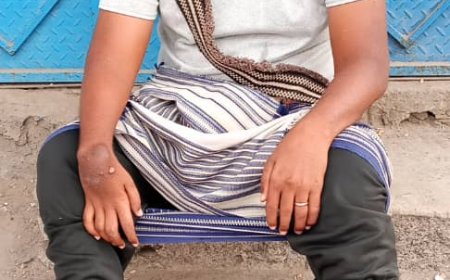 شاب من أبين يناشد ضمائر الخير والمنظمات الإنسانية توفير كرسي كهربائي متحرك