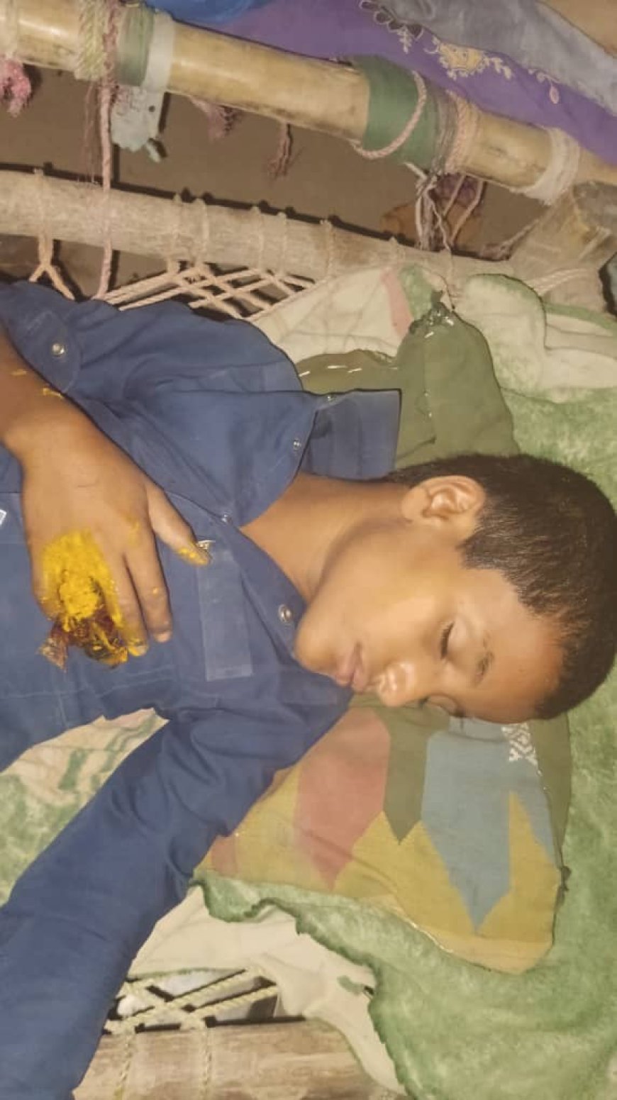 حجة.مدرس يعذب طفل فيها مديرية بني قيس و التربية تتستر.