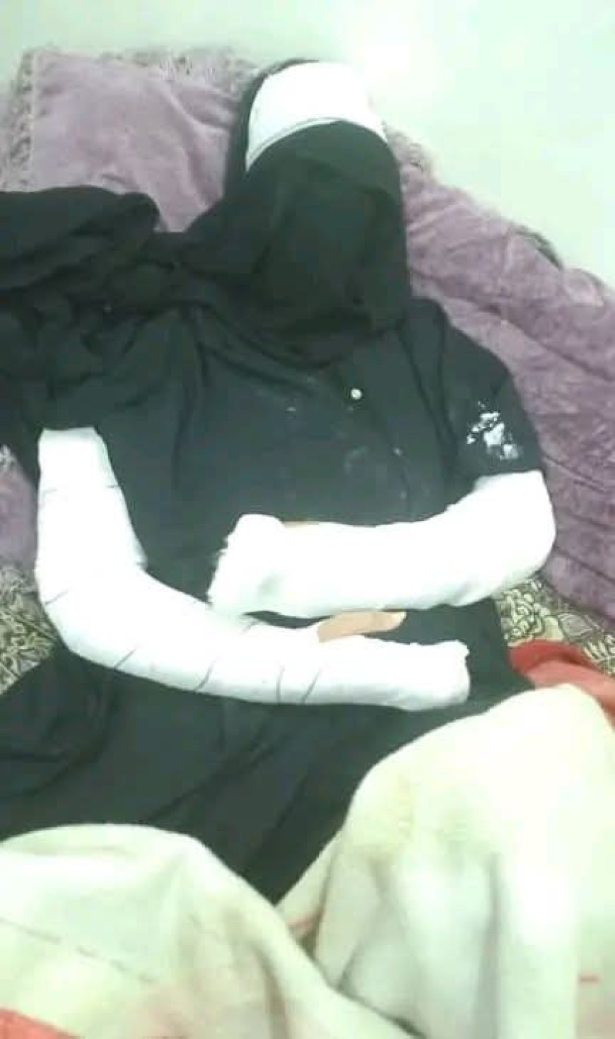 تعز.محامية تتعرض لإعتداء وحشي داخل منزلها من أحد أرقابها.