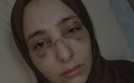 سحر عبدالإله الخولاني.. حين تُعتدى الكرامة في عقر دارها فاعلم أن السقوط الأخلاقي بلغ منتهاه