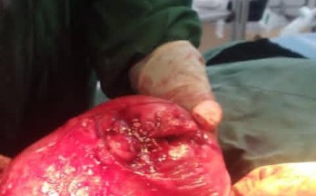 الاستشارية د. عبير العابد.. الكفاءة والإنسانية تنقذان حياة جنين وأمه بعملية نوعية في هيئة مستشفى الرازي العام بأبين