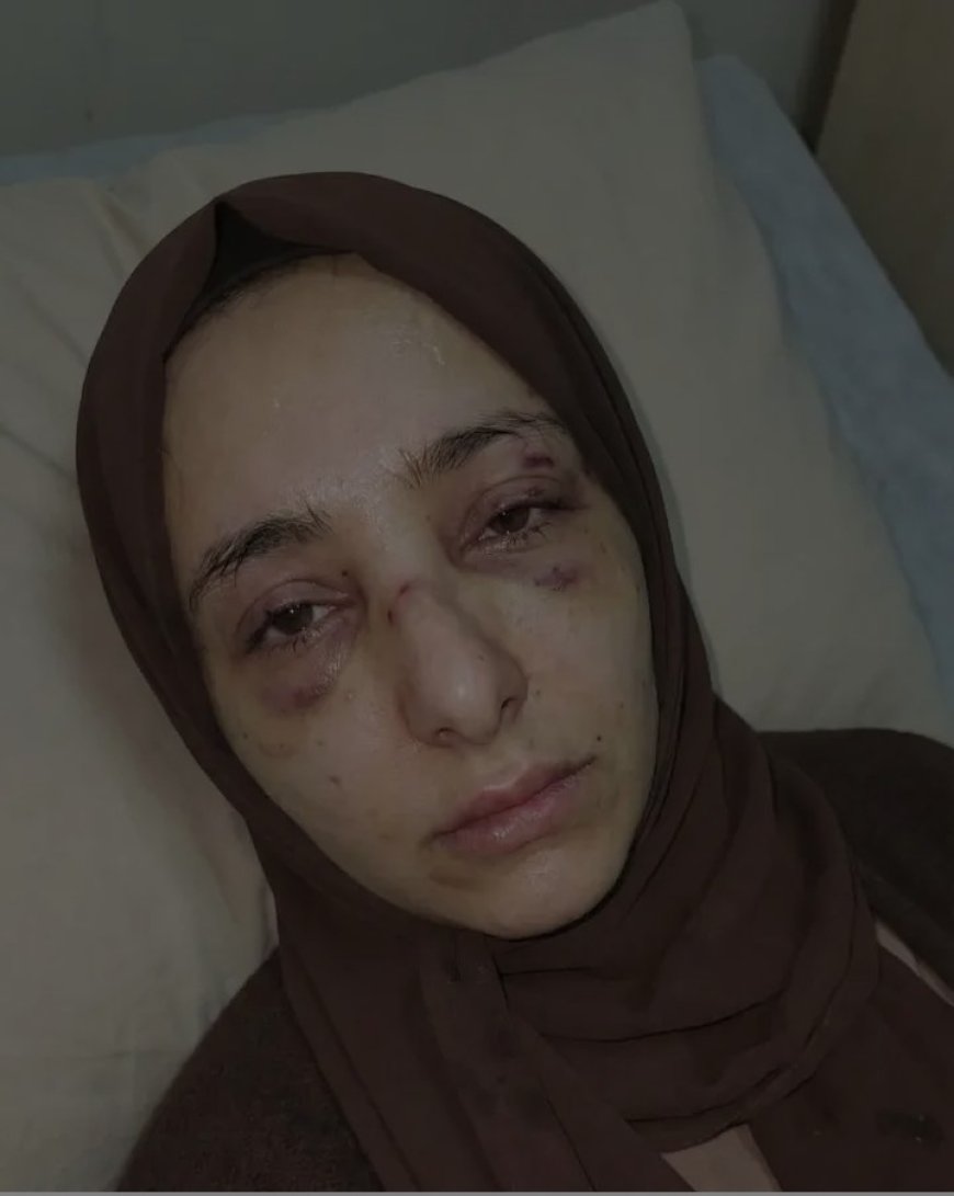 سحر عبدالإله الخولاني.. حين تُعتدى الكرامة في عقر دارها فاعلم أن السقوط الأخلاقي بلغ منتهاه