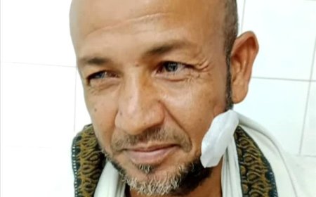 إدانة واستنكار للاعتداء على الصحفي خلدون البرحي في محافظة لحج