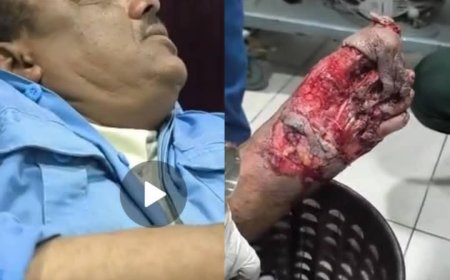 إصابة رجل مرور  بحادث دهس في عتق ومناشدات للتدخل  العاجل  عدن /خاص