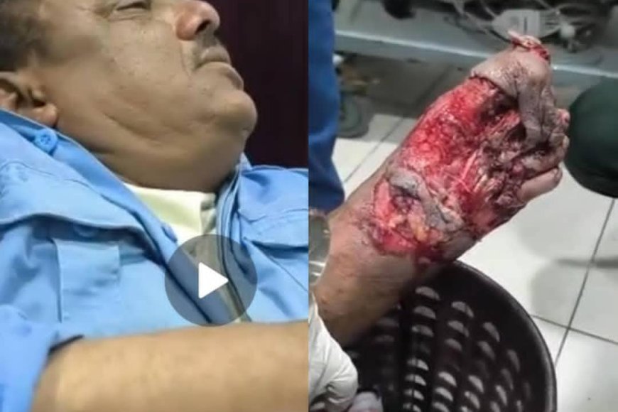 إصابة رجل مرور  بحادث دهس في عتق ومناشدات للتدخل  العاجل  عدن /خاص