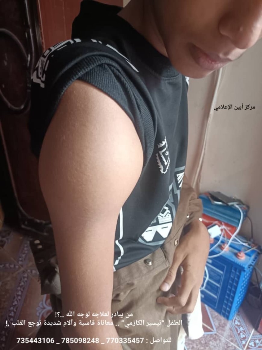 الطفل ”تيسير الكازمي” .. معاناة قاسية وآلام شديدة توجع القلب.. فمن يبادر لعلاجه لوجه الله ؟