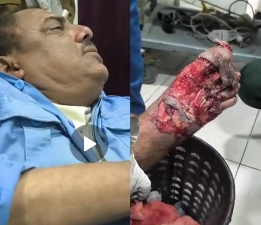 إصابة رجل مرور  بحادث دهس في عتق ومناشدات للتدخل  العاجل  عدن /خاص