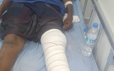 مناشدة إنسانية عاجلة لمساعدة المصاب عثمان باعجير