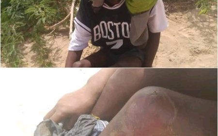 تنامي شكاوى حول انتهاكات وعمليات ابتزاز يتعرض لها مهاجرون أفارقة في مديرية أحور