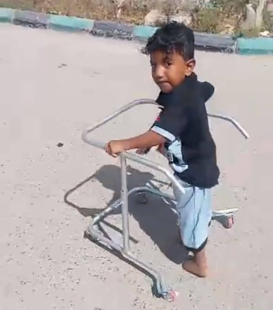 أسرة فقيرة من أبين تناشد الخيرين مساعدتها في إجراء عمليتين جراحيتين لطفليها المصابين بتشوه خلقي معيق للحركة