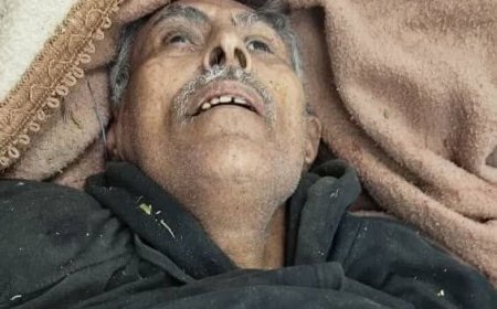 تعز.بعد استهداف طالب وامرأة.. قناصة المليشيا تقتل مسنا وتواصل حصد أرواح المدنيين فيها